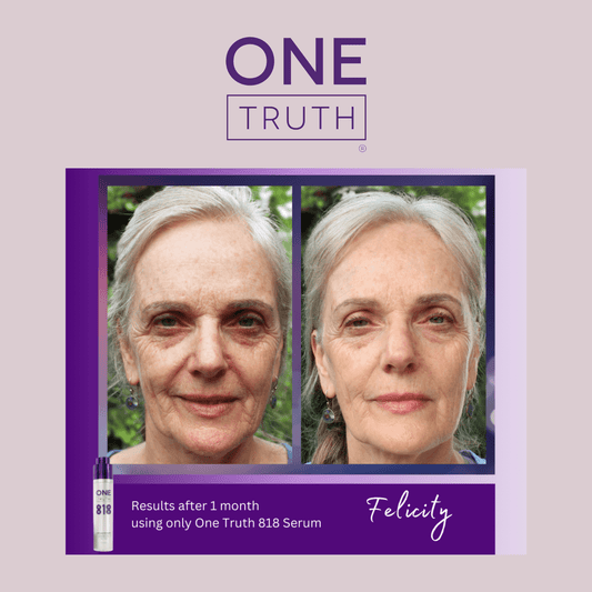Results after 1 month of using One Truth 818 Serum on skin, showcasing improvement in facial appearance.