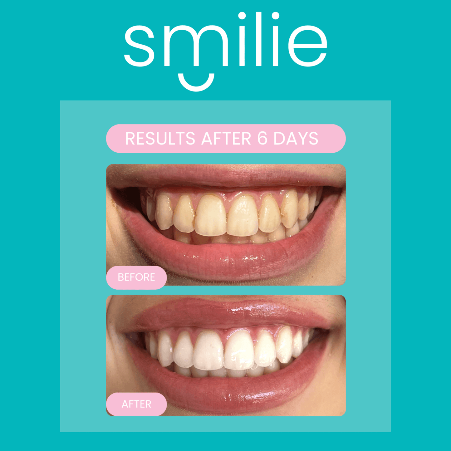 Smilie YouTV Bundle Offer - SAVE OVER 55%!